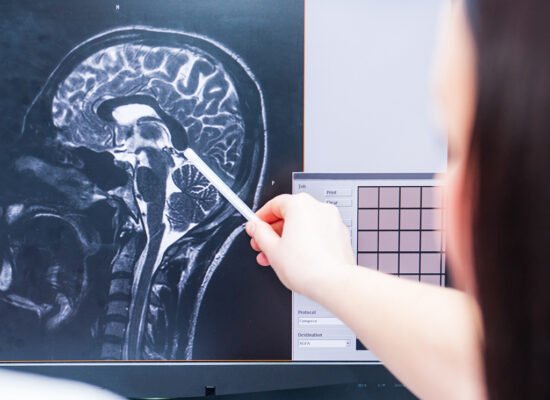 Brain Injury