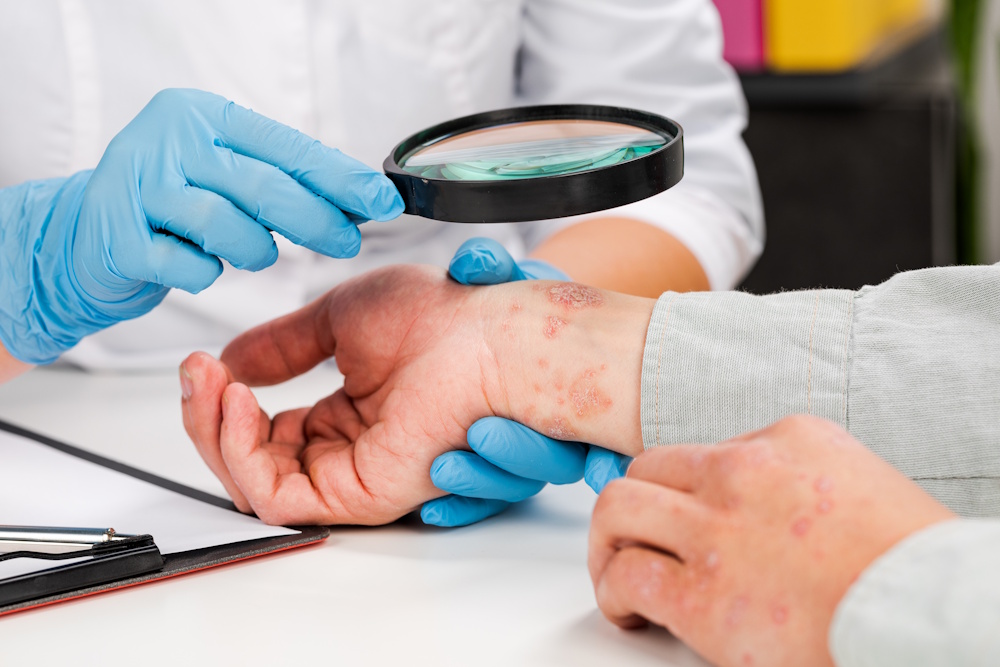 Understanding the Skin Domain in a CHC Assessment